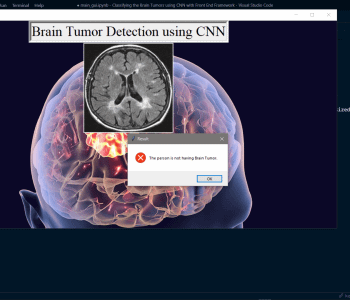 Classifying Brain Tumor
