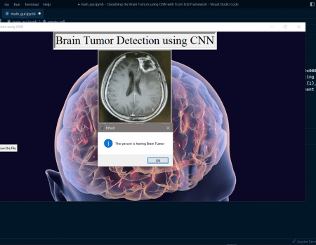 Classifying Brain Tumor Using CNN Classifying Brain Tumor Using CNN